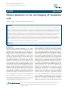 Scholarly article on topic 'Recent advances in live cell imaging of hepatoma cells'