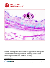 Scholarly article on topic 'Nickel Nanoparticles cause exaggerated lung and airway remodeling in mice lacking the T-box transcription factor, TBX21 (T-bet)'
