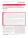 Scholarly article on topic 'Vessel-wall imaging and quantification of flow-mediated dilation using water-selective 3D SSFP-echo'