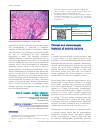 Scholarly article on topic 'Clinical and dermoscopic features of eccrine poroma'