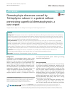 Scholarly article on topic 'Dermatophyte abscesses caused by Trichophyton rubrum in a patient without pre-existing superficial dermatophytosis: a case report'