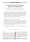 Scholarly article on topic 'A szisztémás lupus erythematosus pulmonalis manifesztációi'