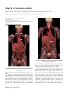 Scholarly article on topic 'FDG-PET of Takayasu’s Arteritis'