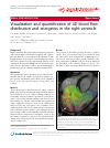 Scholarly article on topic 'Visualization and quantification of 4D blood flow distribution and energetics in the right ventricle'