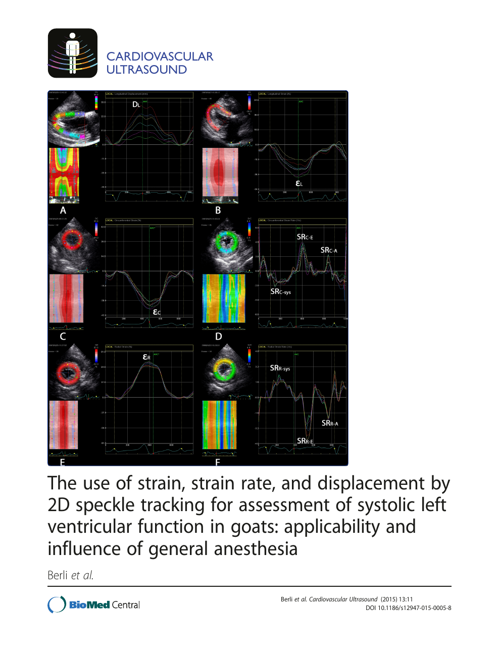 Myocardial strain to detect subtle left ventricular systolic