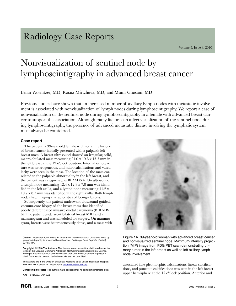 Nonvisualization Of Sentinel Node By Lymphoscintigraphy In Advanced Breast Cancer Topic Of Research Paper In Clinical Medicine Download Scholarly Article Pdf And Read For Free On Cyberleninka Open Science Hub