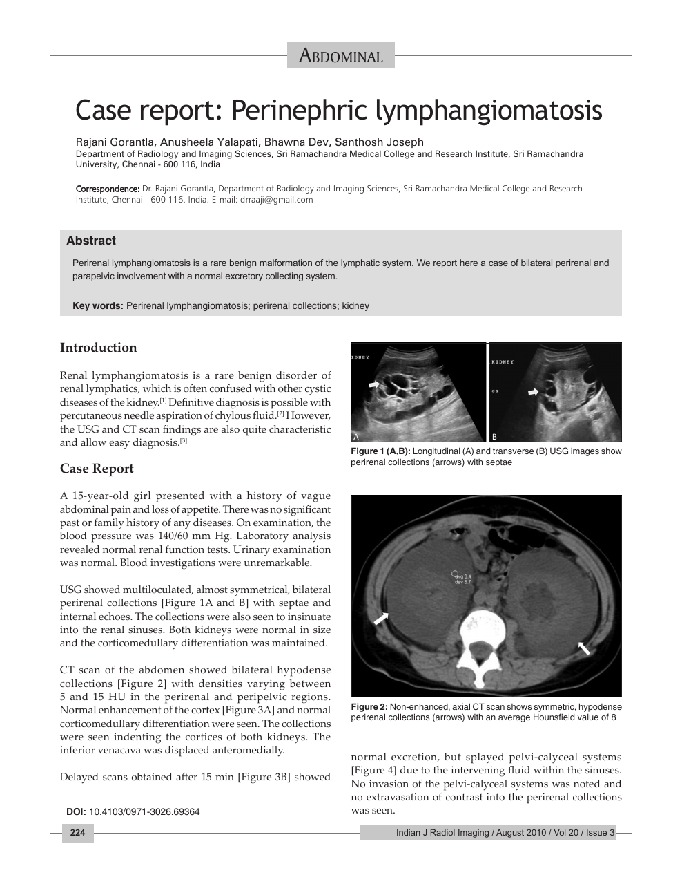 Case Report Perinephric Lymphangiomatosis Topic Of Research Paper In Clinical Medicine Download Scholarly Article Pdf And Read For Free On Cyberleninka Open Science Hub