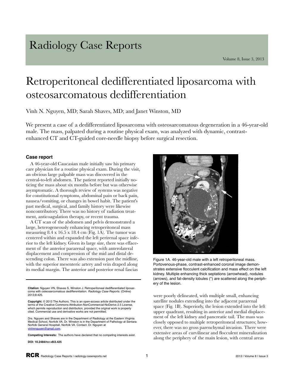 Retroperitoneal Dedifferentiated Liposarcoma With Osteosarcomatous