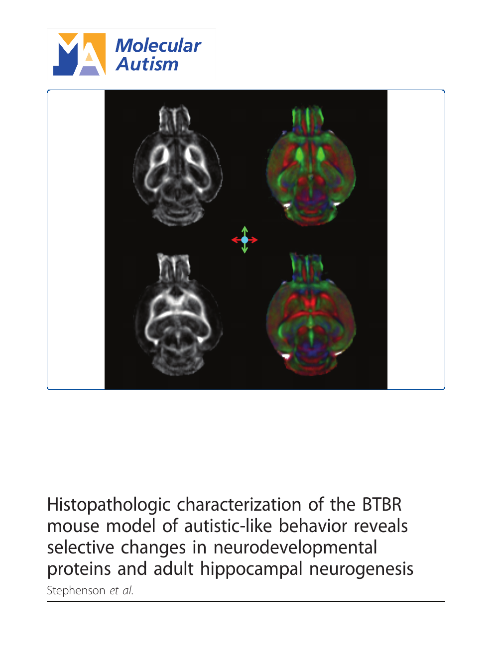 Histopathologic characterization of the BTBR mouse model of