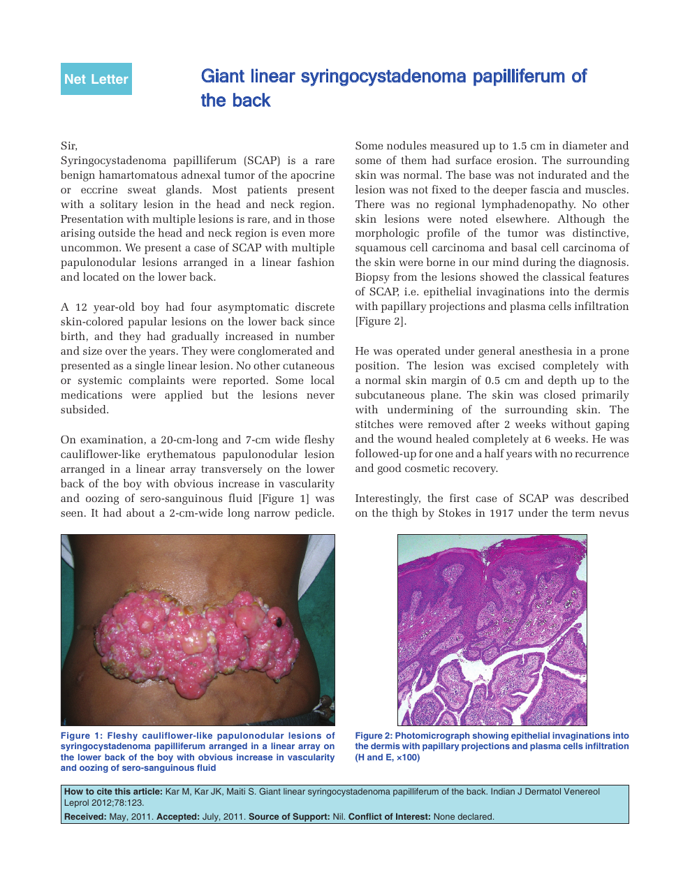 Giant Linear Syringocystadenoma Papilliferum Of The Back Topic Of Research Paper In Clinical Medicine Download Scholarly Article Pdf And Read For Free On Cyberleninka Open Science Hub